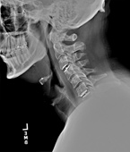 Patient Cases After pic