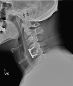 Patient Cases After pic