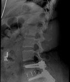 Patient Cases After pic