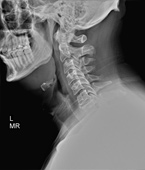 Patient Cases Before pic