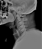 Patient Cases Before pic