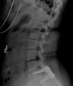 Patient Cases Before pic